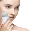 Ultrasonic Blackhead Skin Exfoliator Beauty & Fashion Iconix