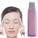 Ultrasonic Blackhead Skin Exfoliator Beauty & Fashion Iconix