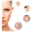 6-in-1 Derma Roller Set Beauty Iconix 