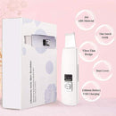 Ultrasonic Blackhead Skin Exfoliator Beauty & Fashion Iconix 