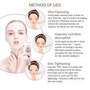 Ultrasonic Blackhead Skin Exfoliator Beauty & Fashion Iconix 